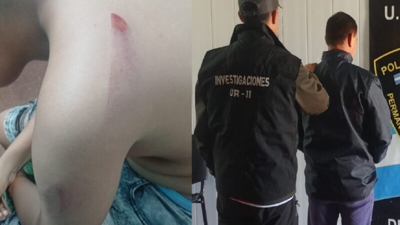 Detuvieron a un empleado municipal por brutal ataque a machetazos a su hijastro de 12 años