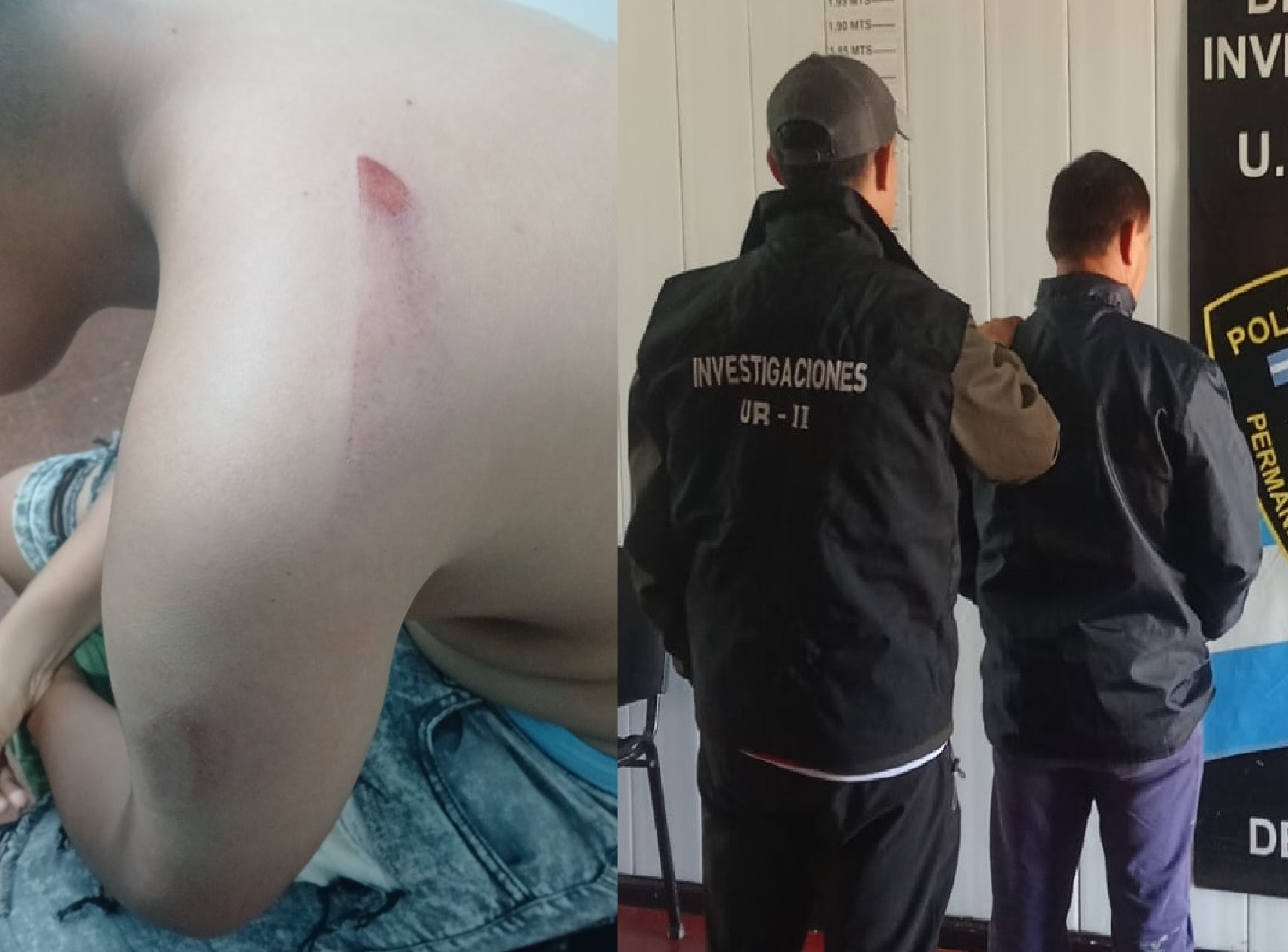 Detuvieron a un empleado municipal por brutal ataque a machetazos a su hijastro de 12 años