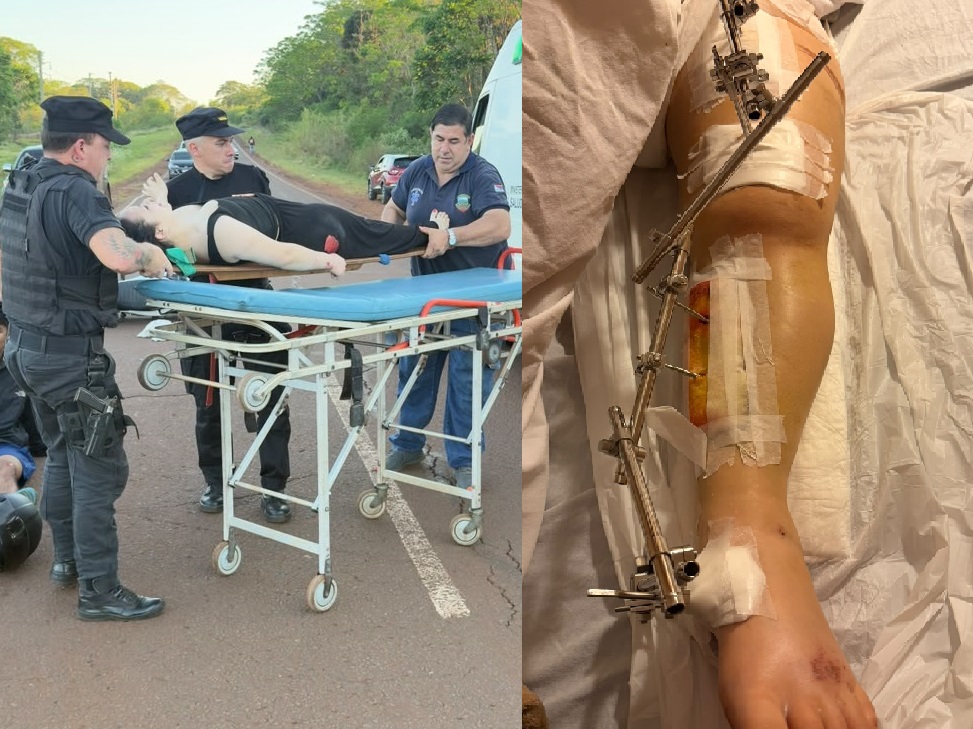 Joven gendarme sufrió múltiples fracturas por impacto de una Hilux cuyo conductor escapó